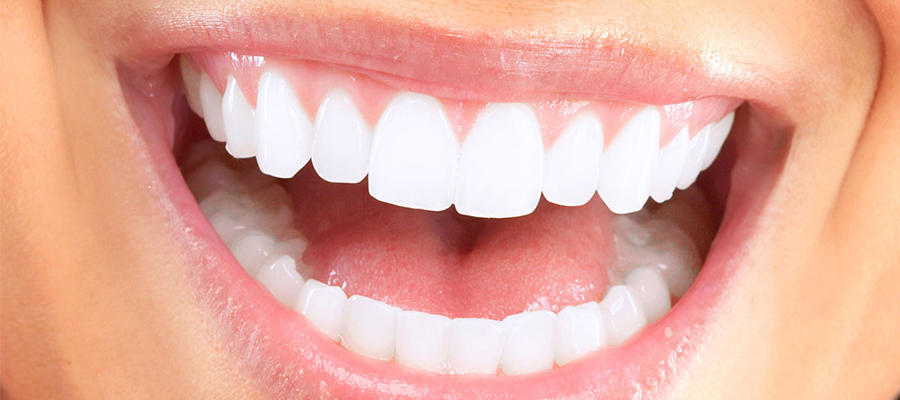 Hollywood Smile en Turquie – Votre guide complet avec Dent of Istanbul