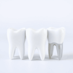 Close-up of three stylized dental crowns side by side, showing zirconia, E-Max ceramic, and metal-ceramic materials with a soft, clean background.
